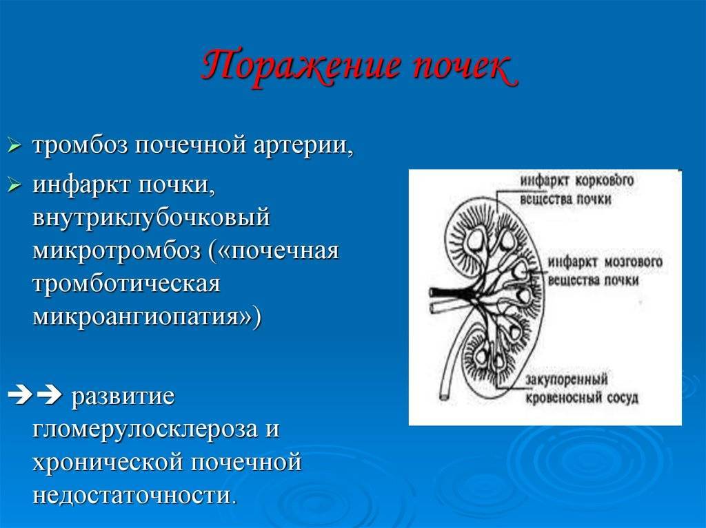 В каких санаториях россии можно лечить почки и заболевания мочеполовой системы